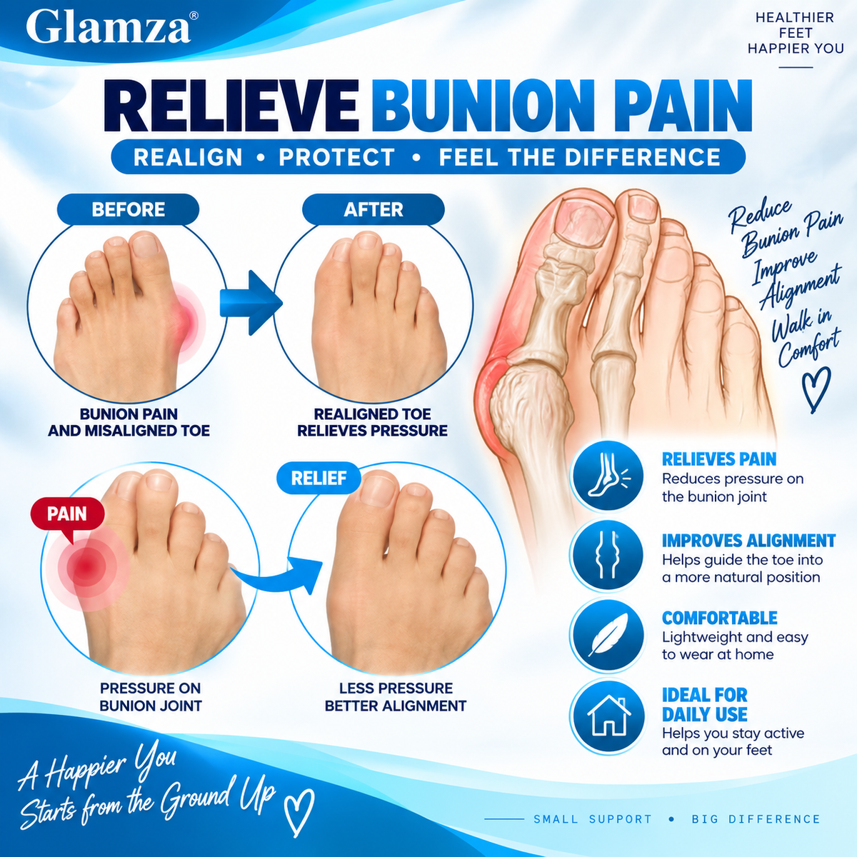 Glamza Bunion Splint Corrector Device Pair – Adjustable Big Toe Alignment Support
