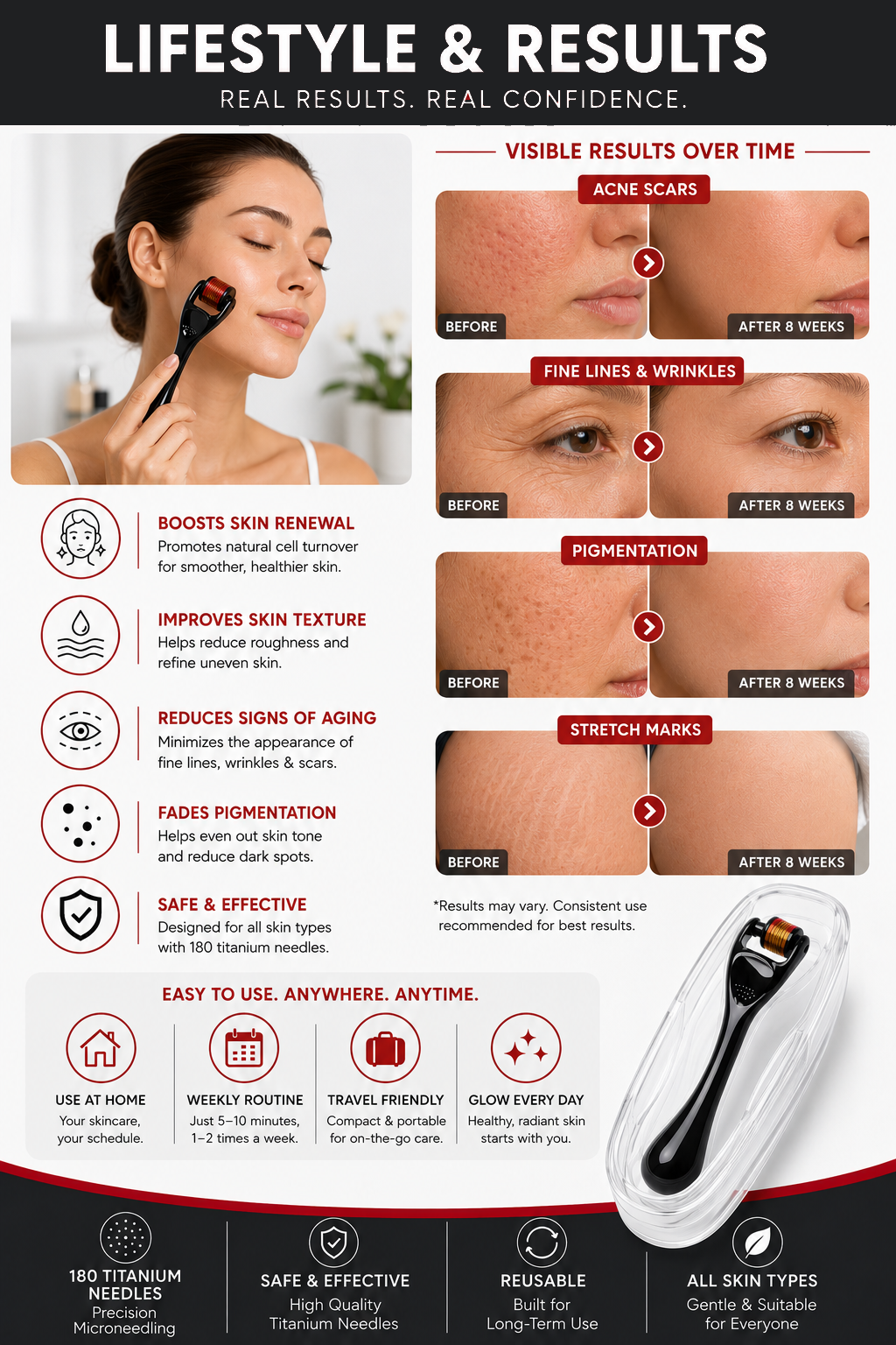 MT 180 Derma Roller 2.0
