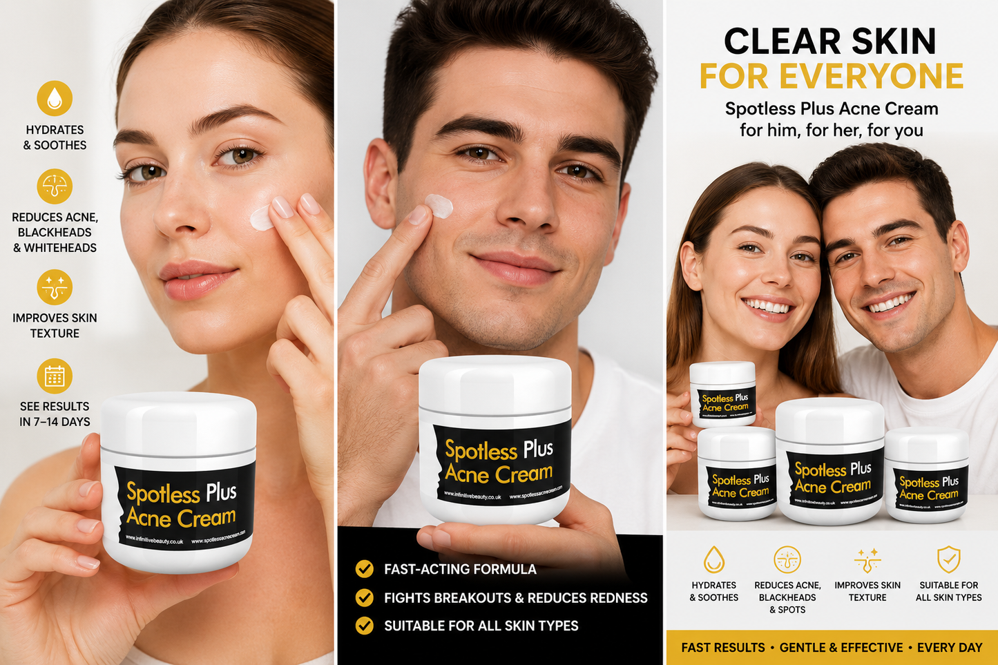 Spotless Plus Acne Cream – Fast-Acting Treatment for Acne, Blackheads & Spots – 50g