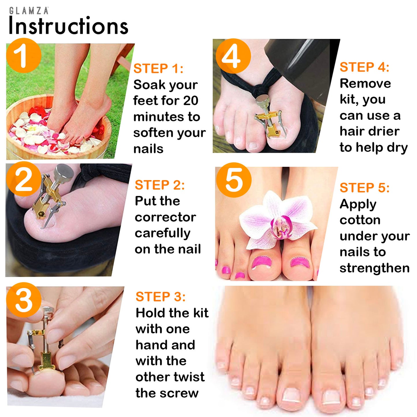 Ingrown Toenail Corrector Clamps – Professional Relief & Nail Reshaping Tool