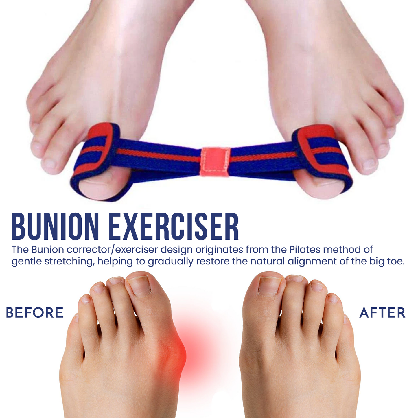 Bunion Exerciser Strap