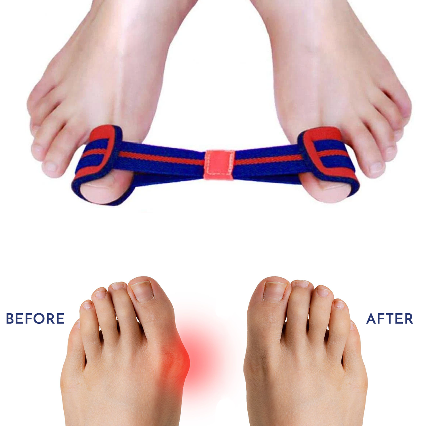 Bunion Exerciser Strap For Happier Feet
