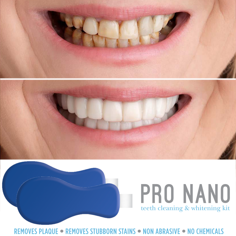 Glamza Pro Nano Teeth Whitening Kit
