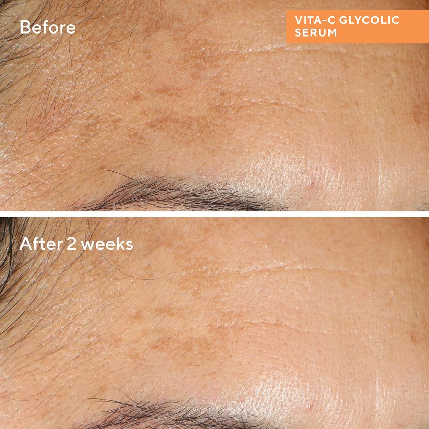 Murad 10ml Vita-C Glycolic Brightening Serum