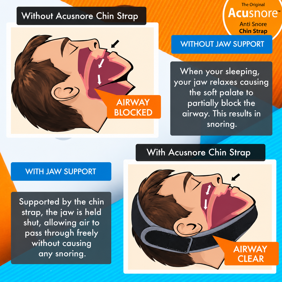 Acusnore Anti-Snore Chin Strap – Your Key to Quieter, Restful Sleep