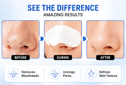 Glamza Deep Cleansing Sticky Nose Strips – Instantly Remove Blackheads & Unclog Pores