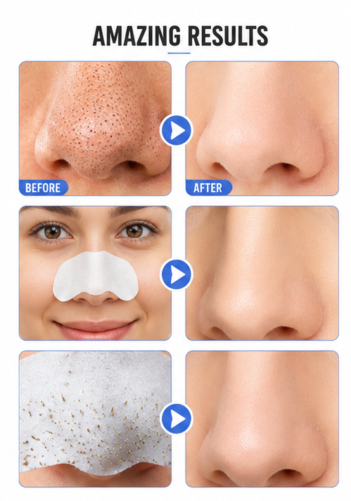 Glamza Deep Cleansing Sticky Nose Strips – Instantly Remove Blackheads & Unclog Pores