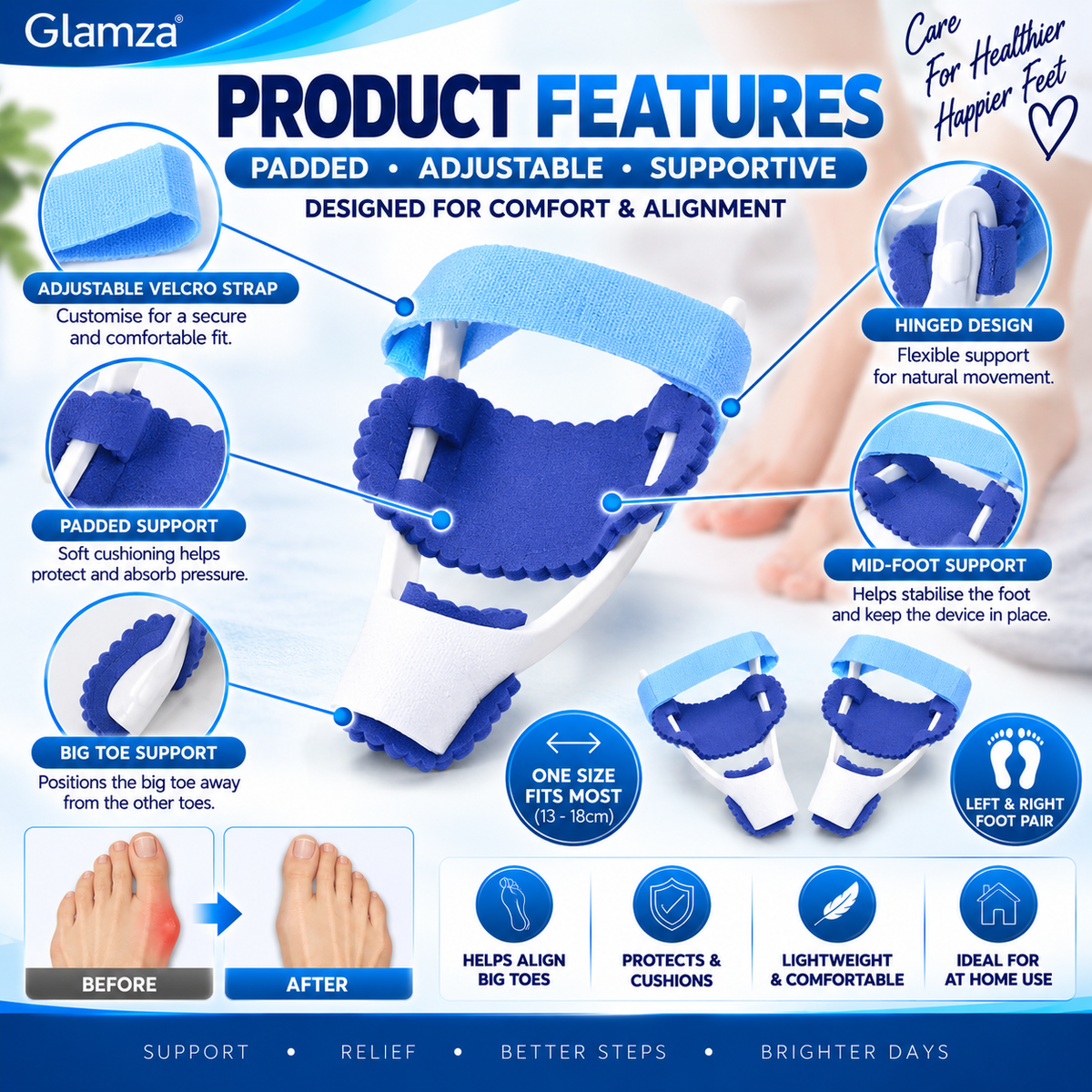 Glamza Bunion Splint Corrector Device Pair – Adjustable Big Toe Alignment Support