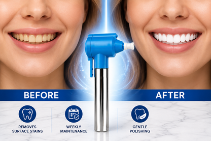 Luma Smile Teeth Whitening and Polishing Device