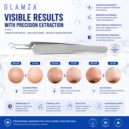 Glamza Curved Blackhead Removal Claw Tweezer – Professional Precision for Clearer Skin