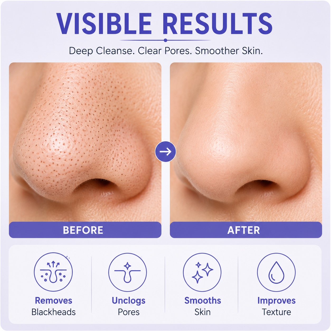Electric Blackhead Remover & Pore Cleanser