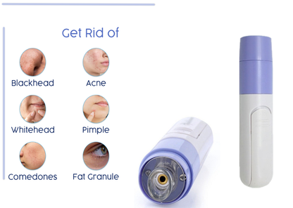 Electric Blackhead Remover & Pore Cleanser