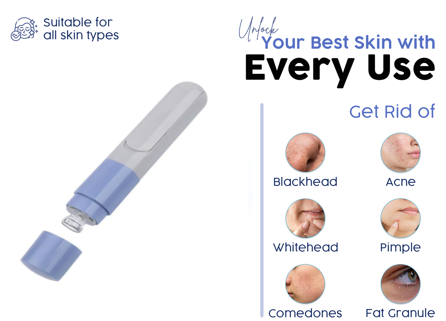 Electric Blackhead Remover & Pore Cleanser