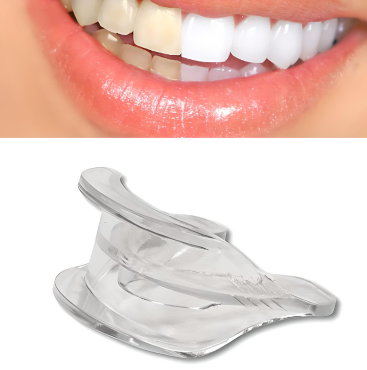 Glamza Double Mouth Tray Teeth Whitening