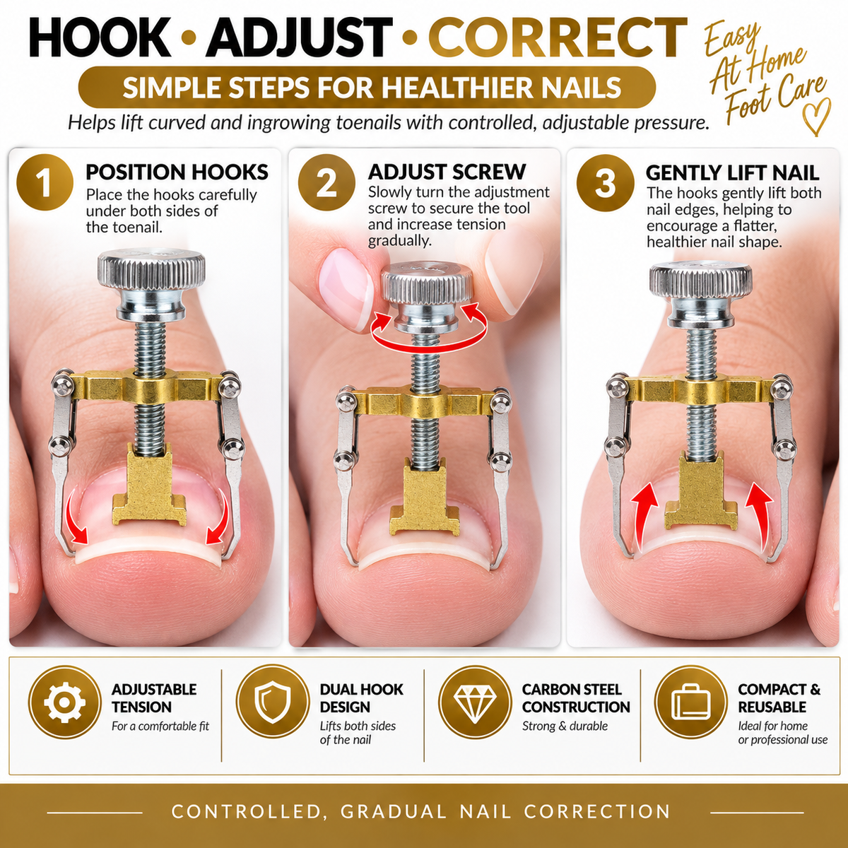 Ingrown Toenail Corrector Clamps – Professional Relief & Nail Reshaping Tool
