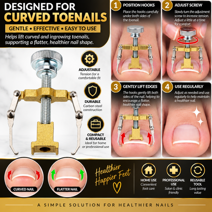 Ingrown Toenail Corrector Clamps – Professional Relief & Nail Reshaping Tool
