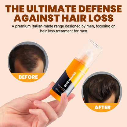 Groomarang Power of Man 3 in 1 Performance 'Hair Loss Prevention Lotion' 100ml…