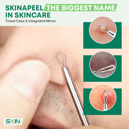 Skinapeel 5pc Blackhead and Blemish Removal Kit With Mirror and Case
