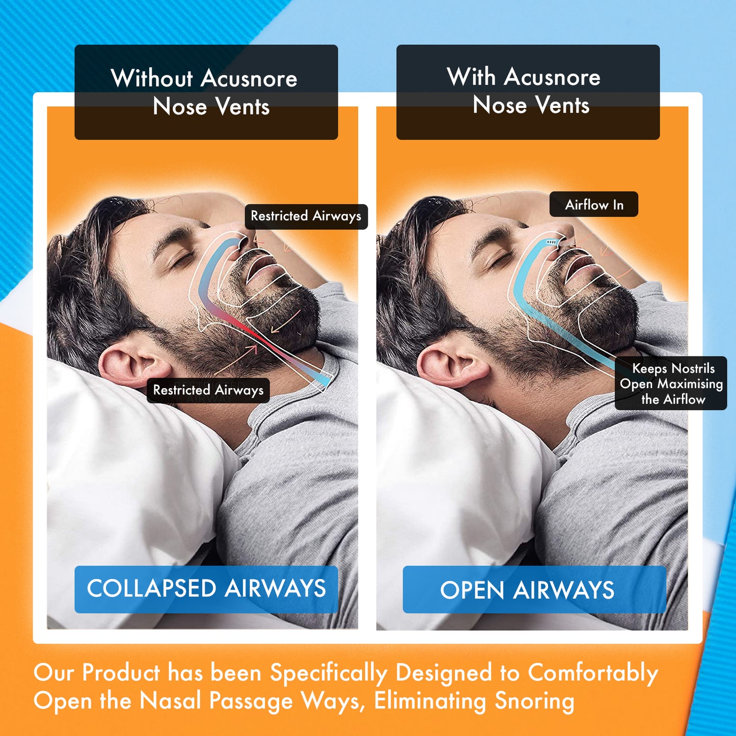 Acusnore Air Flow Nose Vents - 5 Options