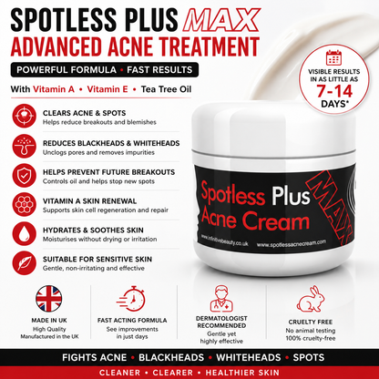 Spotless Plus Max Acne Cream – Powerful Acne Treatment with Vitamin A & Antioxidants – 50g
