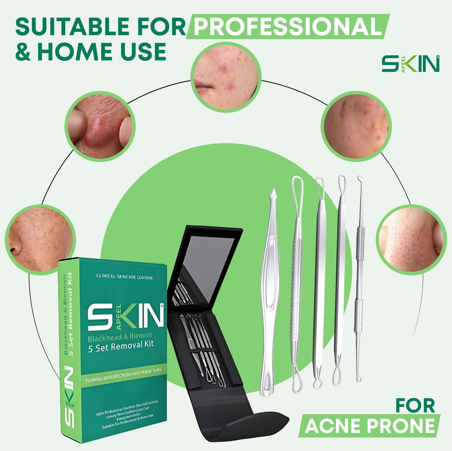 Skinapeel 5pc Blackhead and Blemish Removal Kit With Mirror and Case