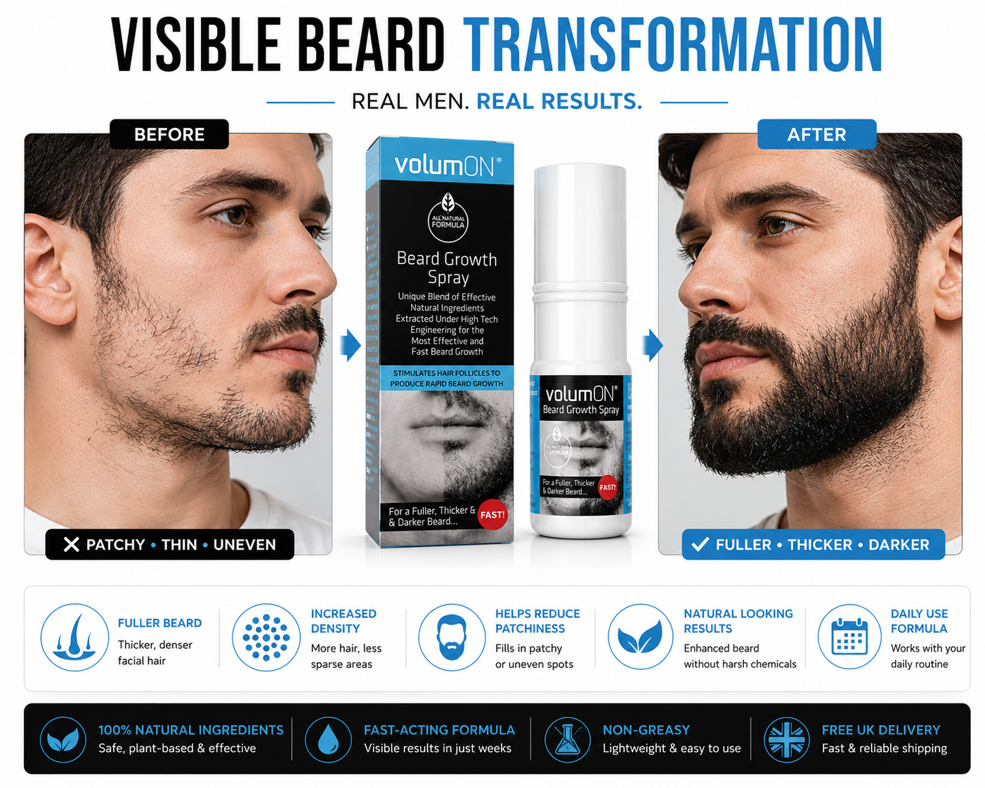 Volumon Beard Growth Spray – 60ml, 120ml, or 180ml – Fuller, Thicker Beard Fast