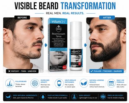 Volumon Beard Growth Spray – 60ml, 120ml, or 180ml – Fuller, Thicker Beard Fast