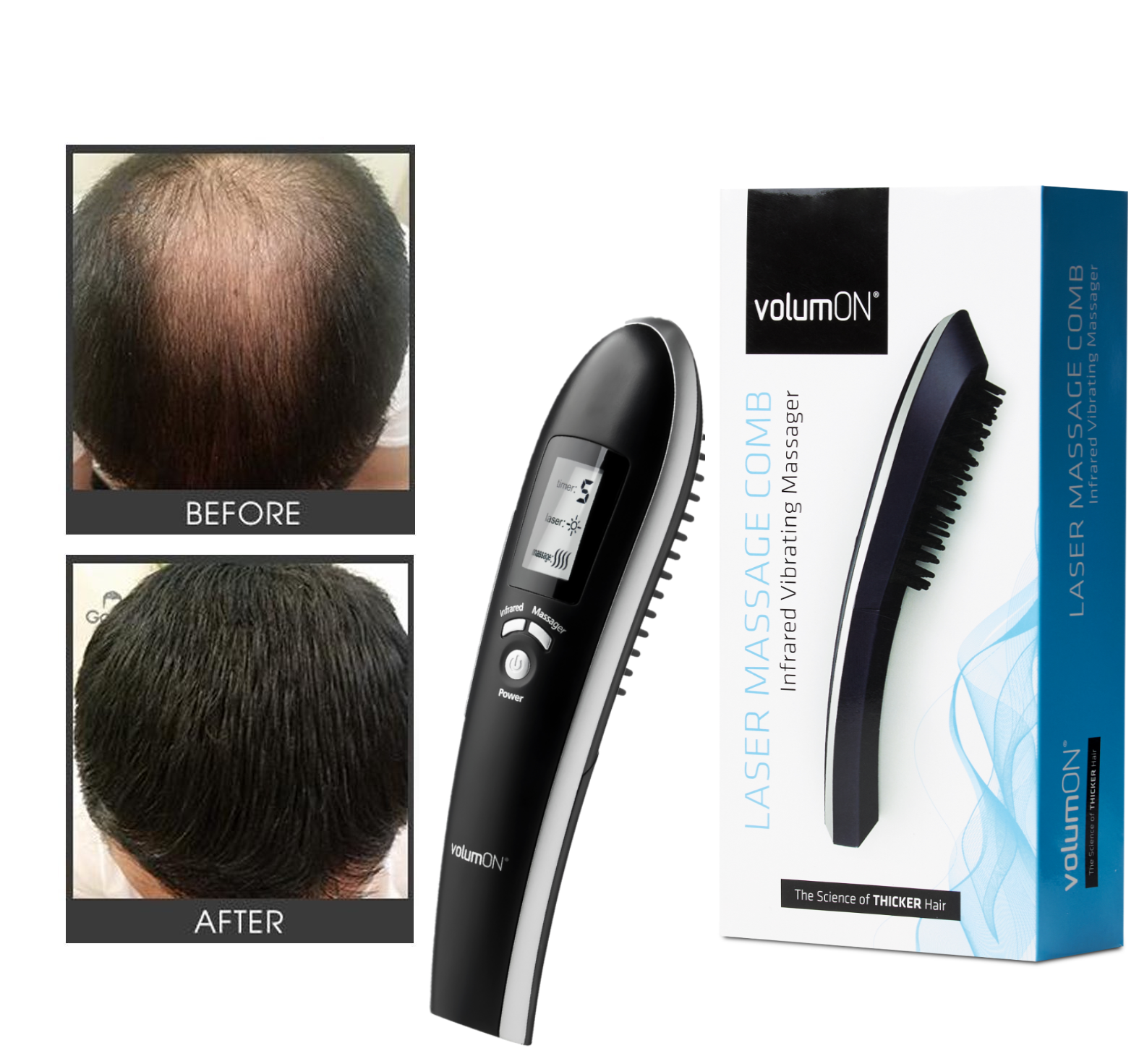 Comb Roday Volumon Laser Hair Massage Comb – Stimulate Hair Growth & Boost Scalp ...