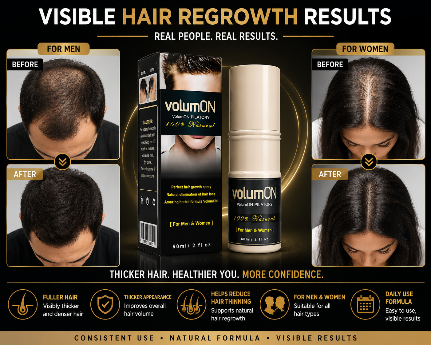 Volumon Hair Regrowth Solution 60ml Spray
