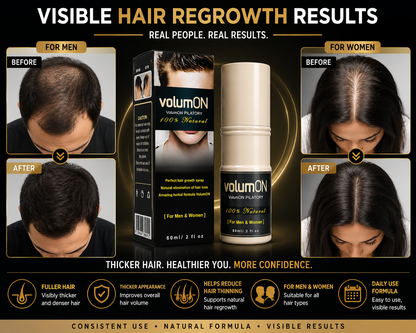 Volumon Hair Regrowth Solution 60ml Spray