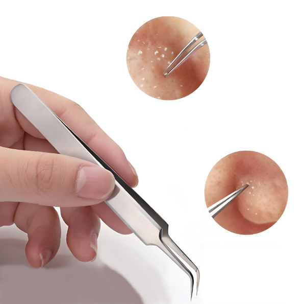 Glamza Blackhead Removal Straight Tweezer