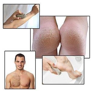 Skinapeel Large Pumice Stone