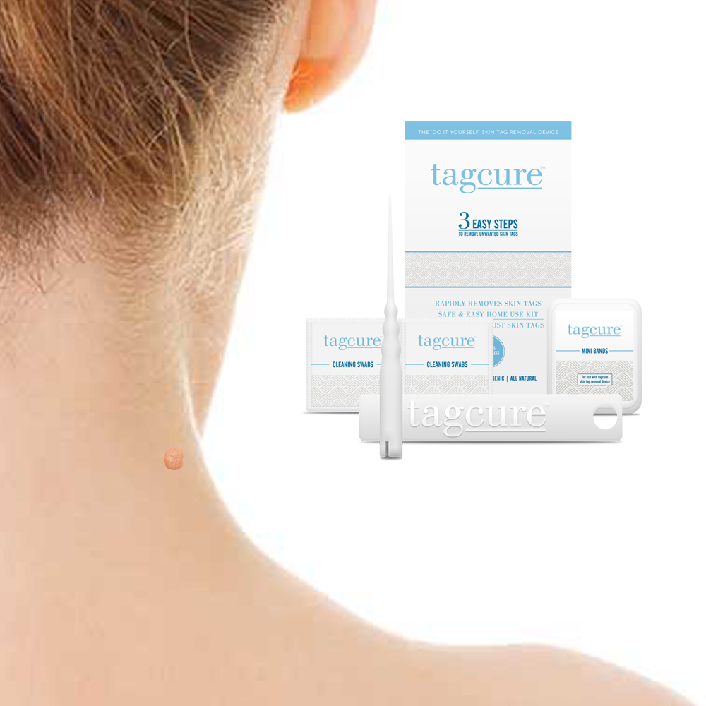 Tagcure - Skin Tag Removal Device - White Packaging