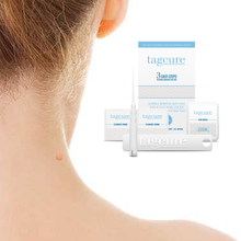 Load image into Gallery viewer, Tagcure - Skin Tag Removal Device - White Packaging