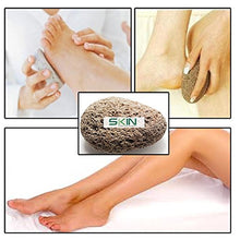 Load image into Gallery viewer, Skinapeel Large Pumice Stone