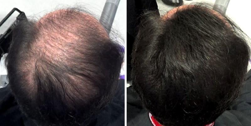 Volumon Hair Building Fibres - KERATIN 12g