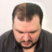 Load image into Gallery viewer, Volumon Hair Building Fibres - COTTON 28g - For Men &amp; Women