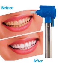 Load image into Gallery viewer, Luma Smile Teeth Whitening and Polishing Device