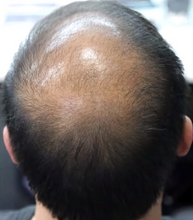 Load image into Gallery viewer, Volumon Hair Building Fibres - COTTON 28g - For Men &amp; Women