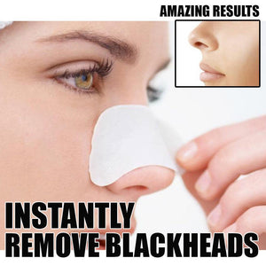 Glamza Deep Cleansing Nose Strips for Blackheads