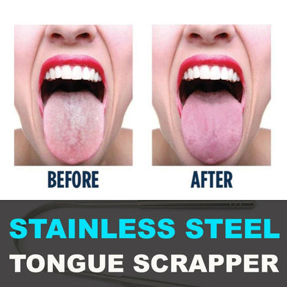 Glamza Stainless Steel Tongue Scraper
