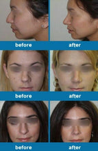 Load image into Gallery viewer, Glamza Perfect Nose Corrector Clip