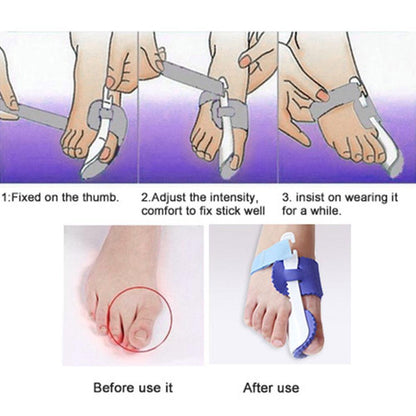 Glamza Splint Corrector Device - Pair