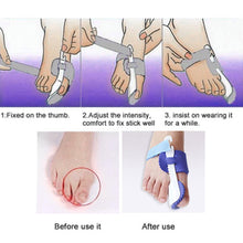 Load image into Gallery viewer, Glamza Splint Corrector Device - Pair
