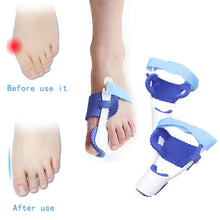 Load image into Gallery viewer, Glamza Splint Corrector Device - Pair