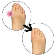 Load image into Gallery viewer, Glamza Splint Corrector Device - Pair