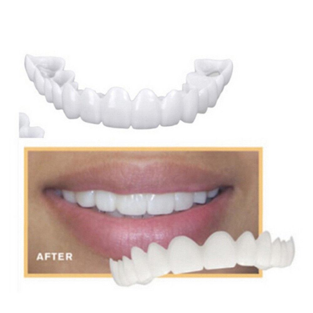 Glamza Get Set Smile Veneers
